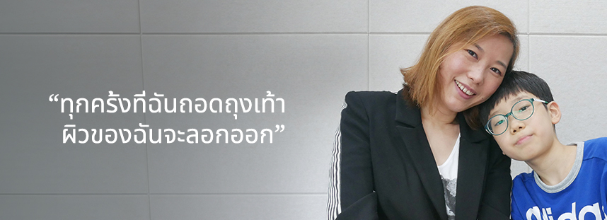 ทุกครั้งที่ฉันถอดถุงเท้า ผิวของฉันจะลอกออก