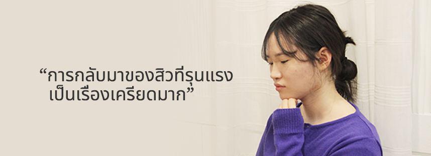 การกลับมาของสิวที่รุนแรงเป็นเรื่องเครียดมาก 