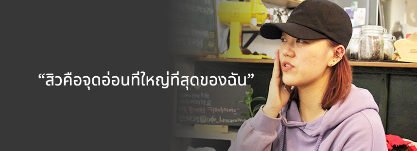 สิวคือจุดอ่อนที่ใหญ่ที่สุดของฉัน