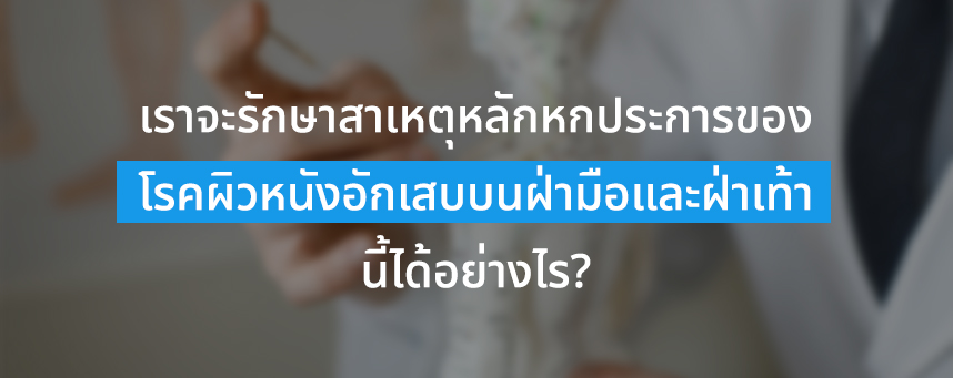 เราจะรักษาสาเหตุหลักหกประการของโรคผิวหนังอักเสบบนฝ่ามือและฝ่าเท้านี้ได้อย่างไร?