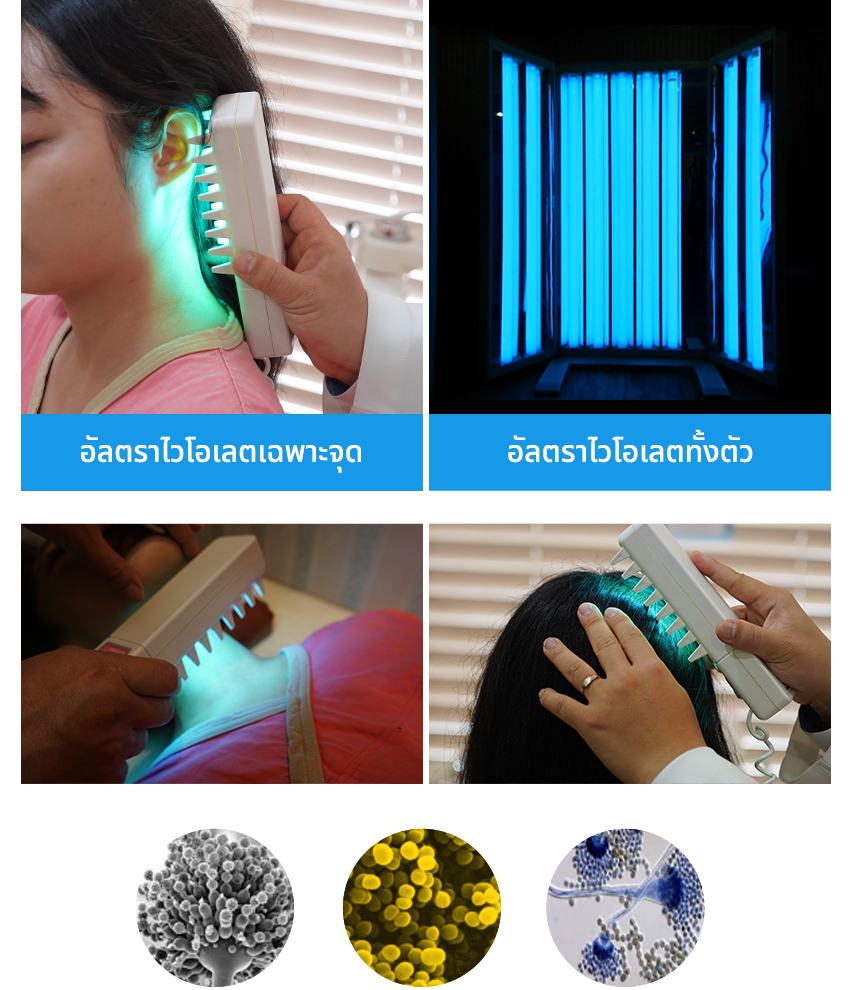 อัลตราไวโอเลตเฉพาะจุด, อัลตราไวโอเลตทั้งตัว