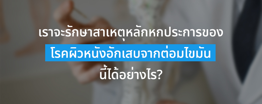 เราจะรักษาสาเหตุหลักหกประการของโรคผิวหนังอักเสบจากต่อมไขมันนี้ได้อย่างไร?