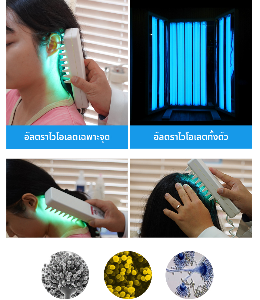 อัลตราไวโอเลตเฉพาะจุด, อัลตราไวโอเลตทั้งตัว