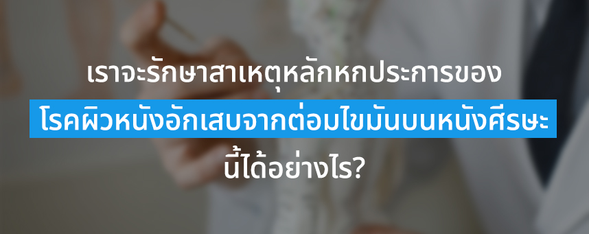 เราจะรักษาสาเหตุหลักหกประการของโรคผิวหนังอักเสบจากต่อมไขมันบนหนังศีรษะนี้ได้อย่างไร?