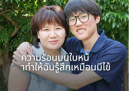 ความร้อนบนใบหน้าทำให้ฉันรู้สึกเหมือนมีไข้