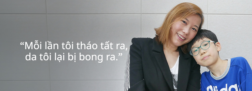 Mỗi lần tôi tháo tất ra, da tôi lại bị bong ra.