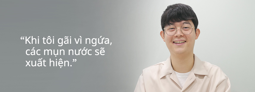 Khi tôi gãi vì ngứa, các mụn nước sẽ xuất hiện.