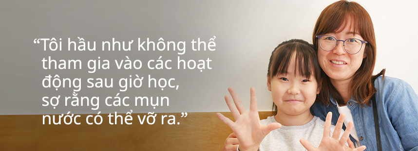 Vết phát ban trông giống như những đường dài, vì vậy tôi không nghĩ đó là mề đay.