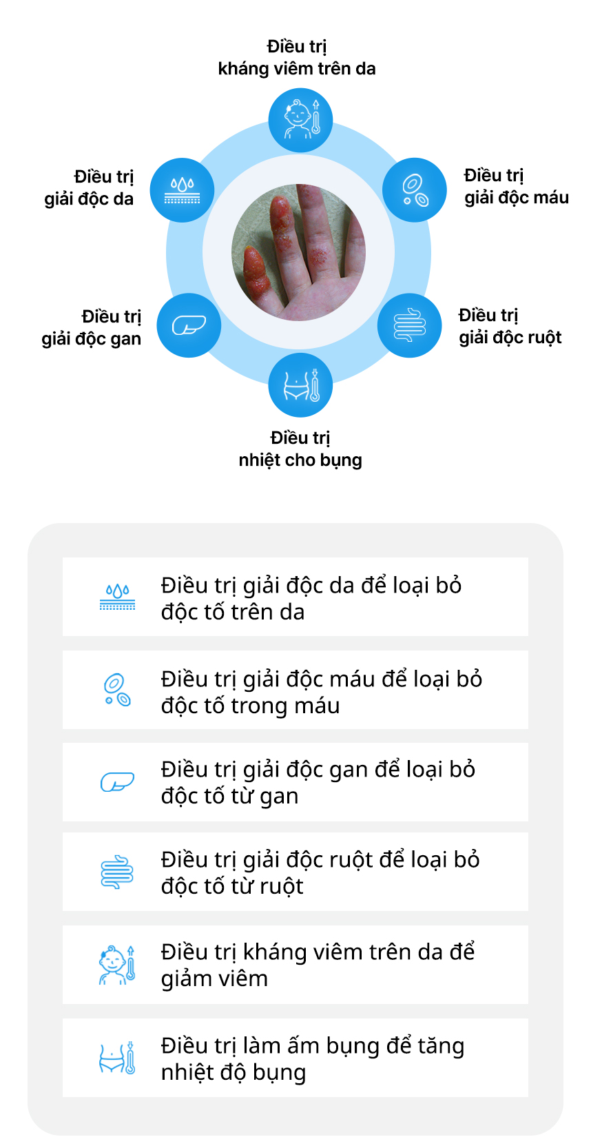 Điều trị Chàm tổ đỉa tích hợp, Điều trị giải độc da, Điều trị giải độc máu, Điều trị giải độc gan, Điều trị giải độc ruột, Điều trị kháng viêm trên da, Điều trị nhiệt cho bụng 