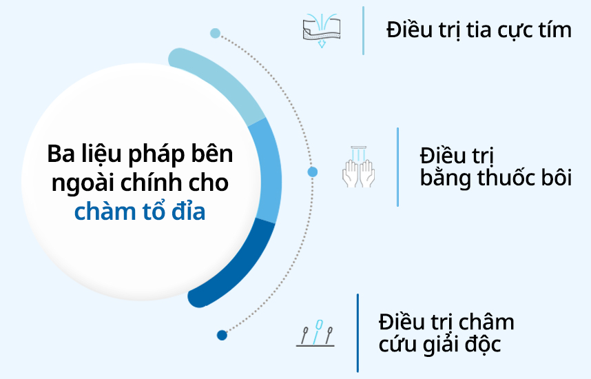 Ba liệu pháp bên ngoài chính cho Chàm tổ đỉa