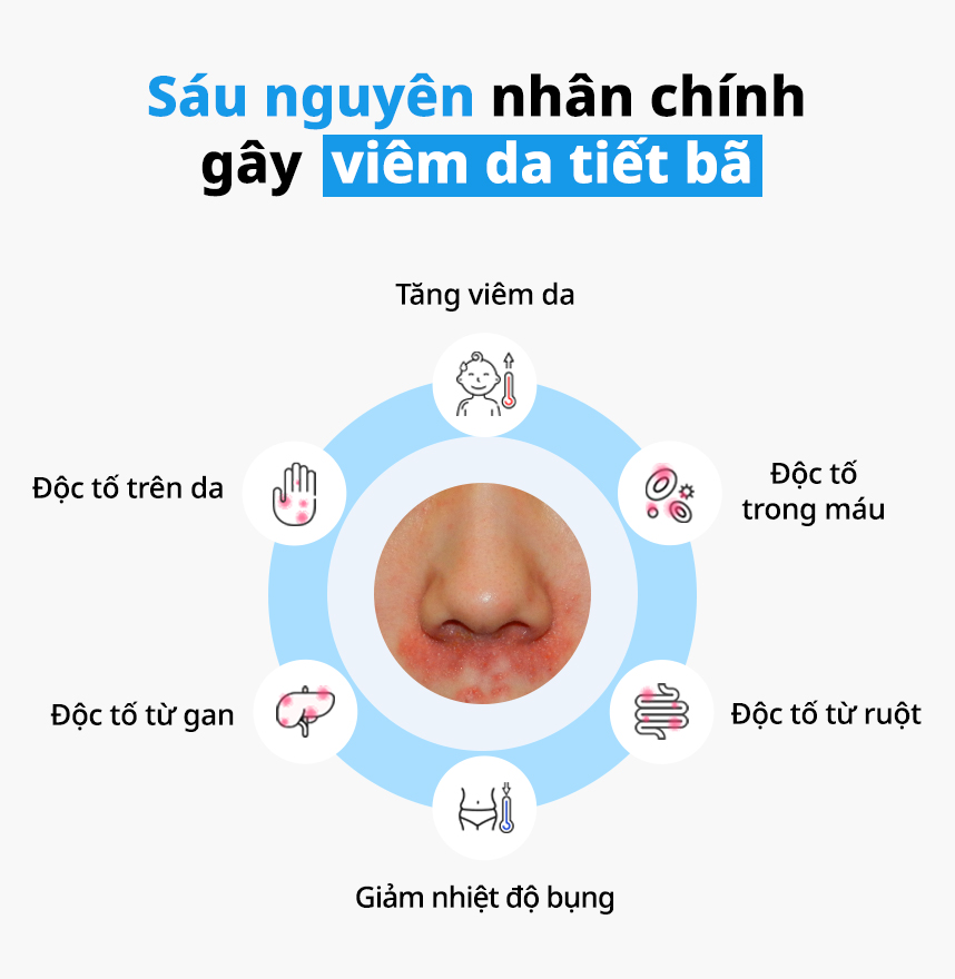 Sáu nguyên nhân chính gây Viêm da tiết bã