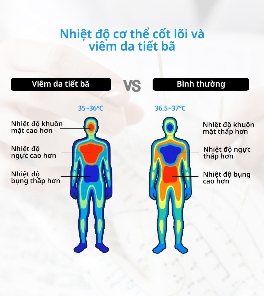 Nhiệt độ cơ thể cốt lõi và Viêm da tiết bã