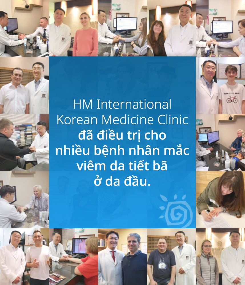 HM International Korean Medicine Clinic đã điều trị cho nhiều bệnh nhân mắc Viêm da tiết bã ở da đầu.