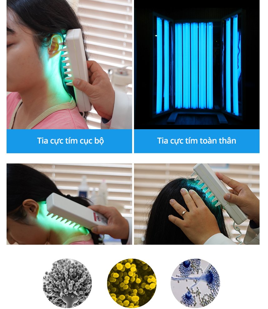 Tia cực tím cục bộ, Tia cực tím toàn thân