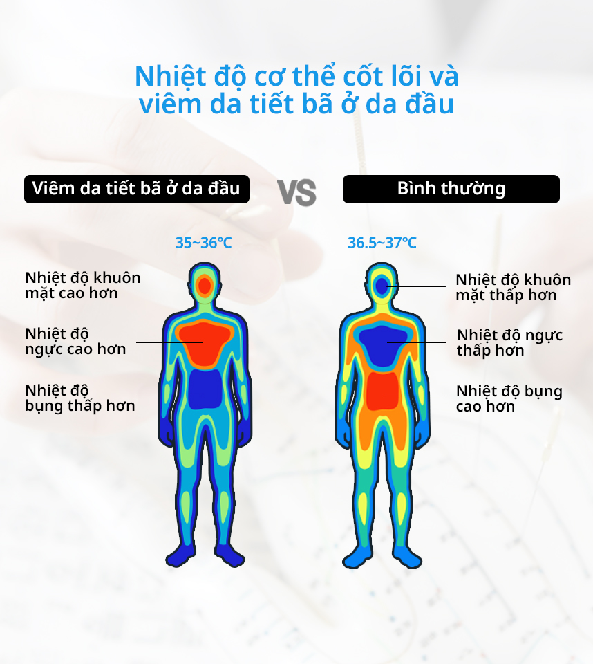 Nhiệt độ cơ thể cốt lõi và Viêm da tiết bã ở da đầu