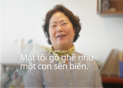 Mặt tôi gồ ghề như một con sên biển.