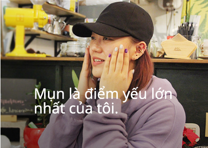 Mụn là điểm yếu lớn nhất của tôi.