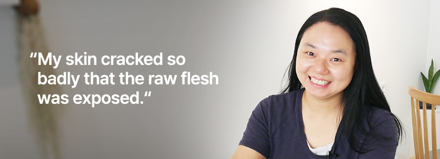 속살이 드러날 정도로 쩍쩍 갈라졌어요.