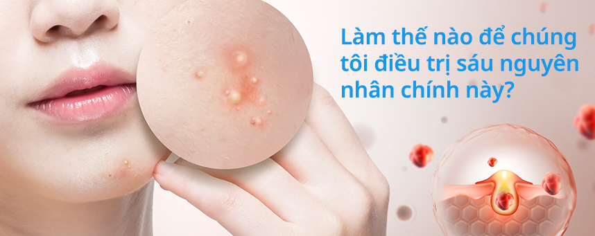Làm thế nào để chúng tôi điều trị sáu nguyên nhân chính này?