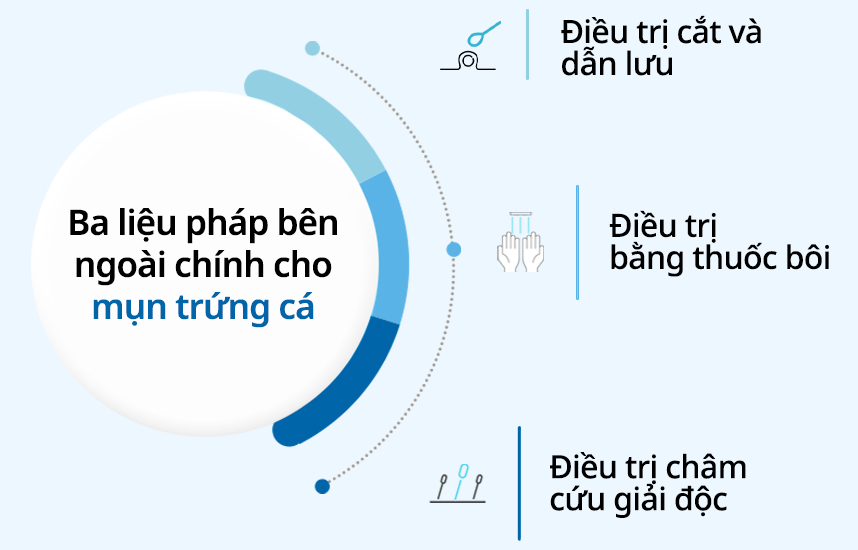 Ba liệu pháp bên ngoài chính cho mụn trứng cá